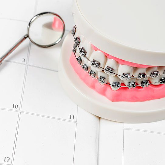 Your Straight Smile Treatment Plan - MyOrthodontist - orthodontics,straight smile orthodontics straight smile